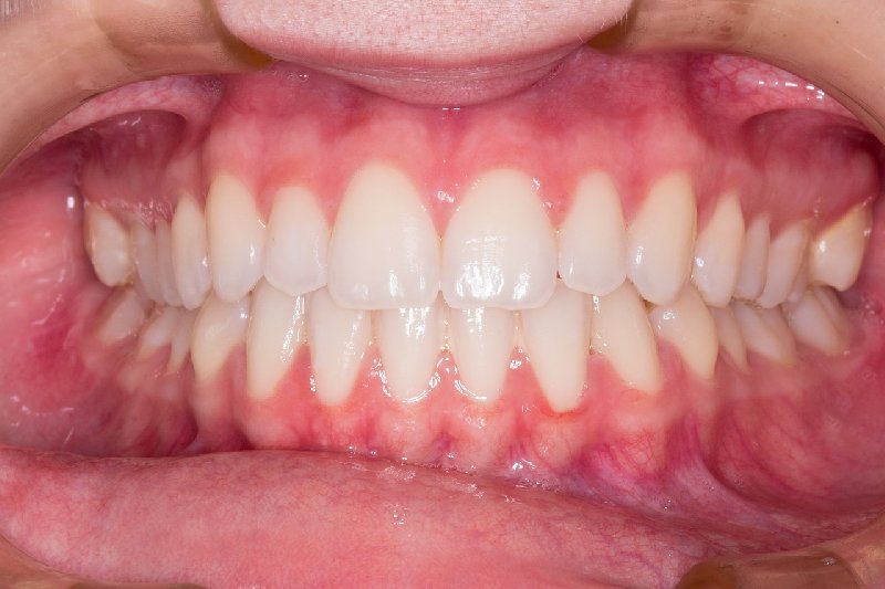 Nowoczesna stomatologia